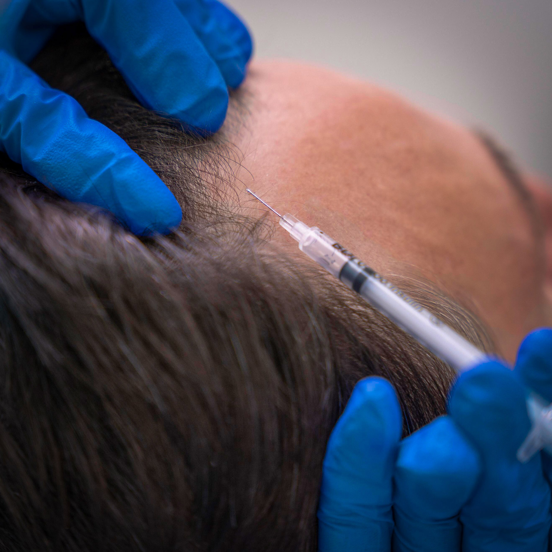 medhair durban non surgical