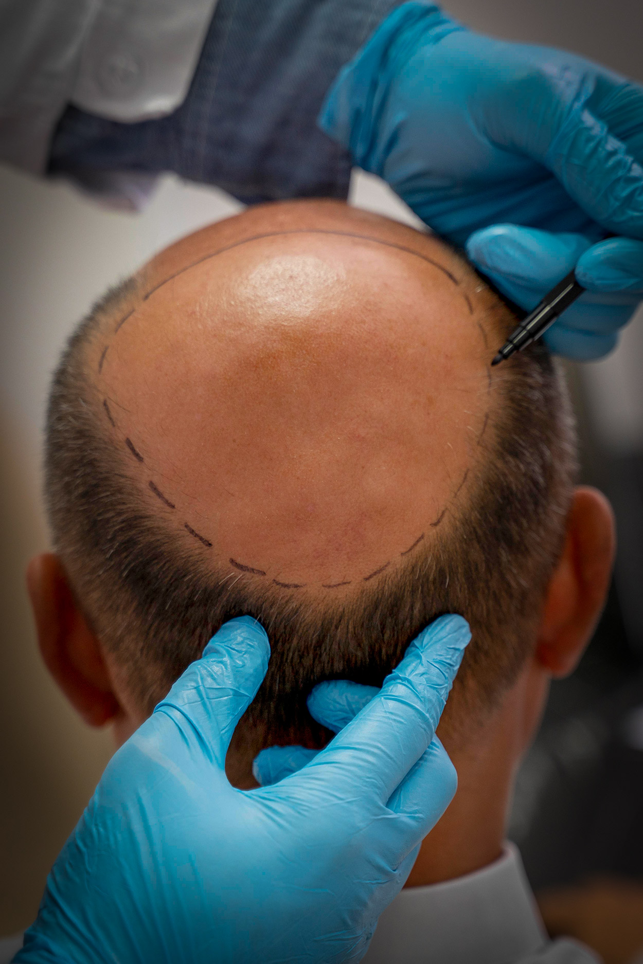 medhair durban prp combo