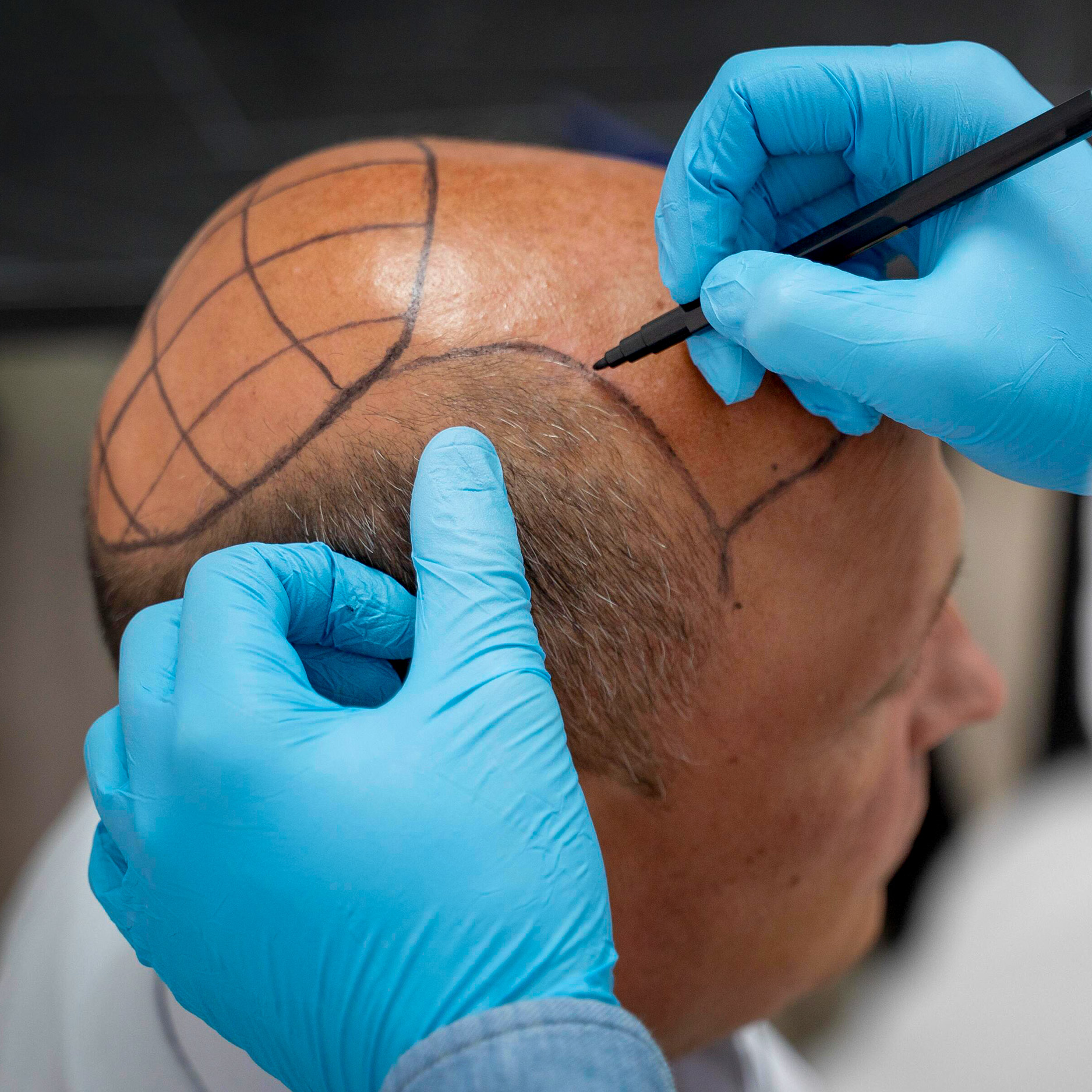 medhair durban surgical