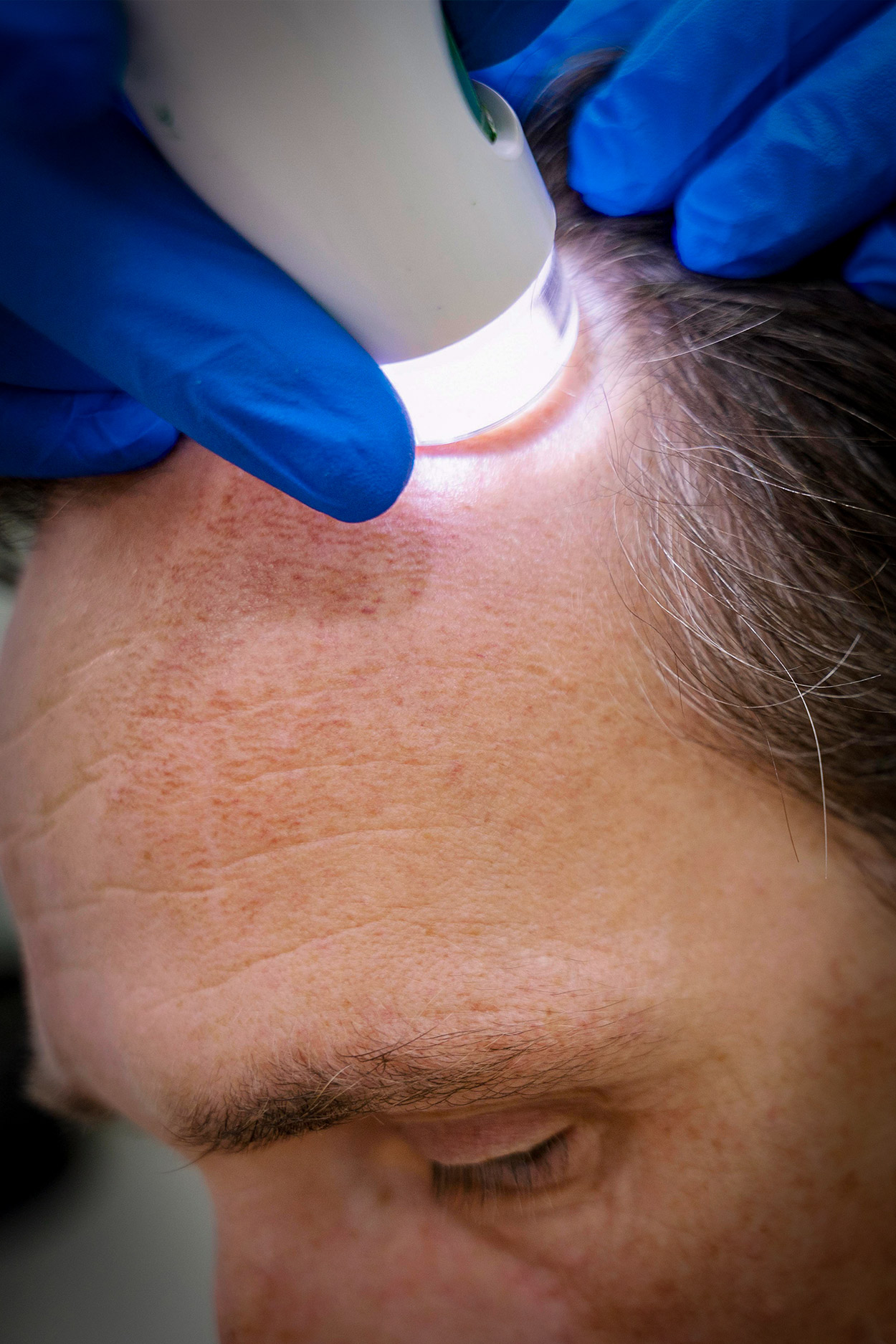 medhair durban treatment price