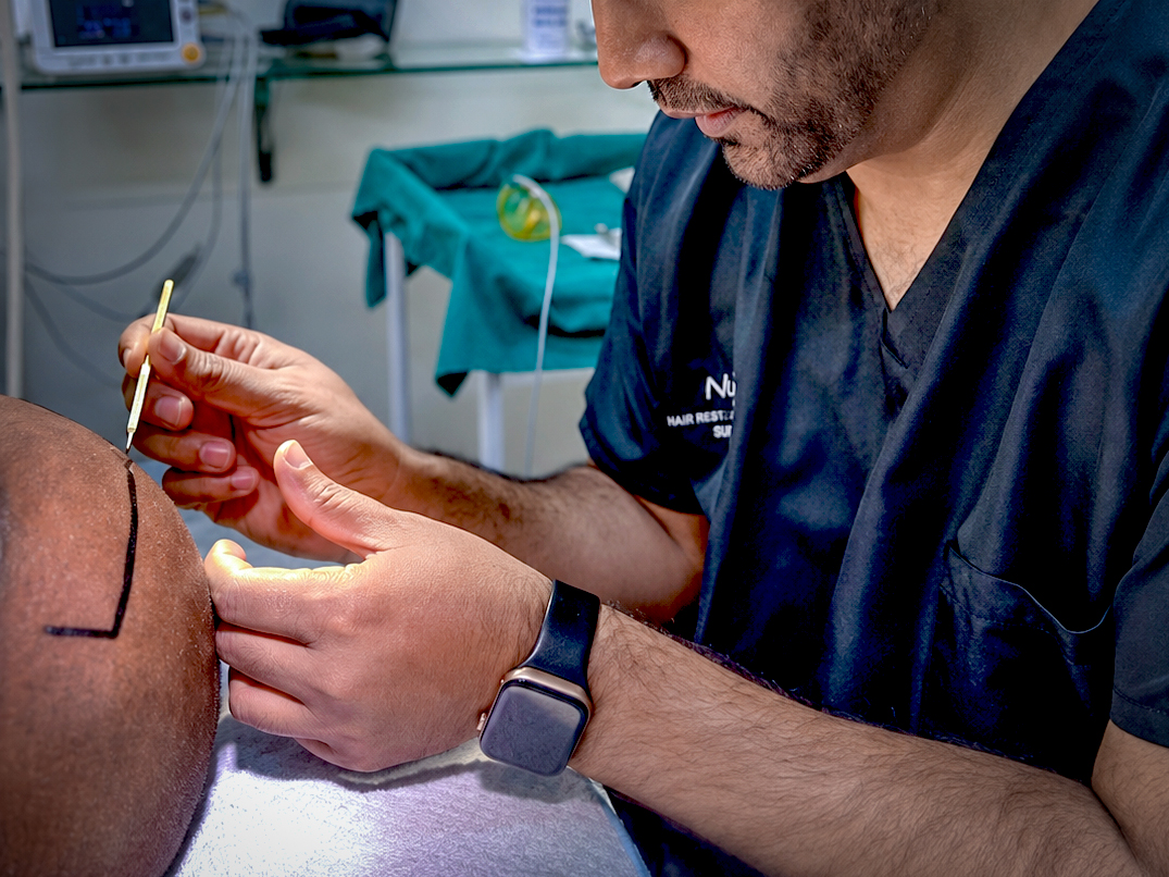 medhair durban transplant home
